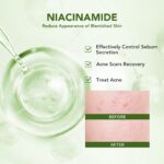 YOU AcnePlus Spot Care with 4D Centella Niacinamide Acne Removal Herbal Care (15g) [Buy 1 Free 1] hanya RM14.32 di Shopee